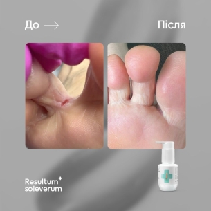 Resultum Soleverum – regenerating soap for feet and... 2