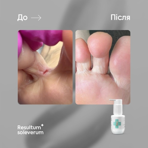 Resultum Soleverum – regenerating soap for feet...