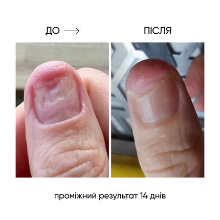 NAILSOFTHEDAY ONISTOP – regenerating oil against onycholysis, 8 ml