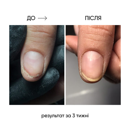 NAILSOFTHEDAY ONISTOP – regenerating oil against onycholysis, 8 ml