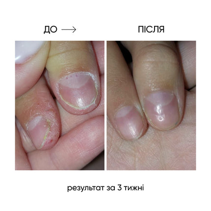 NAILSOFTHEDAY ONISTOP – regenerating oil against onycholysis, 8 ml