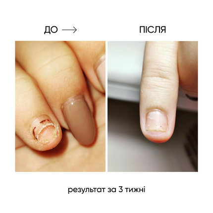 NAILSOFTHEDAY ONISTOP – regenerating oil against onycholysis, 8 ml
