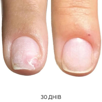 NAILSOFTHEDAY ONISTOP – regenerating oil against onycholysis, 8 ml