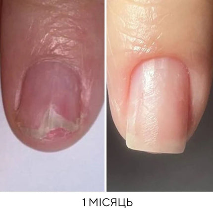 NAILSOFTHEDAY ONISTOP – regenerating oil against onycholysis, 8 ml
